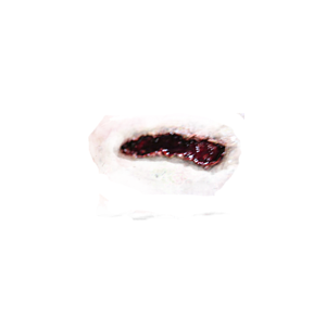 wound PNG image-6271